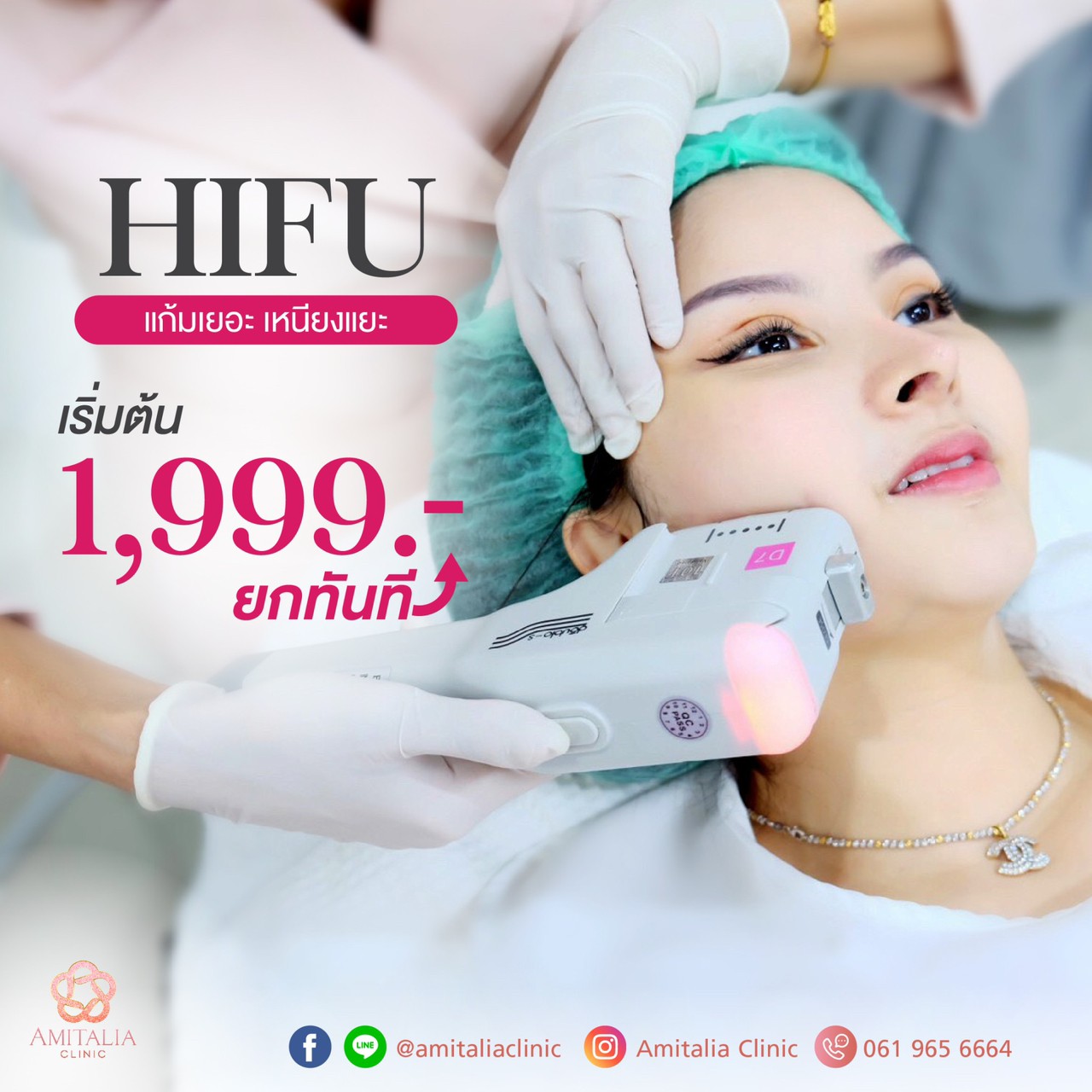 นาทีทอง !!!!! Hifu ยกกระชับหน้าเรียว 1,999.- ไม่จำกัดshot