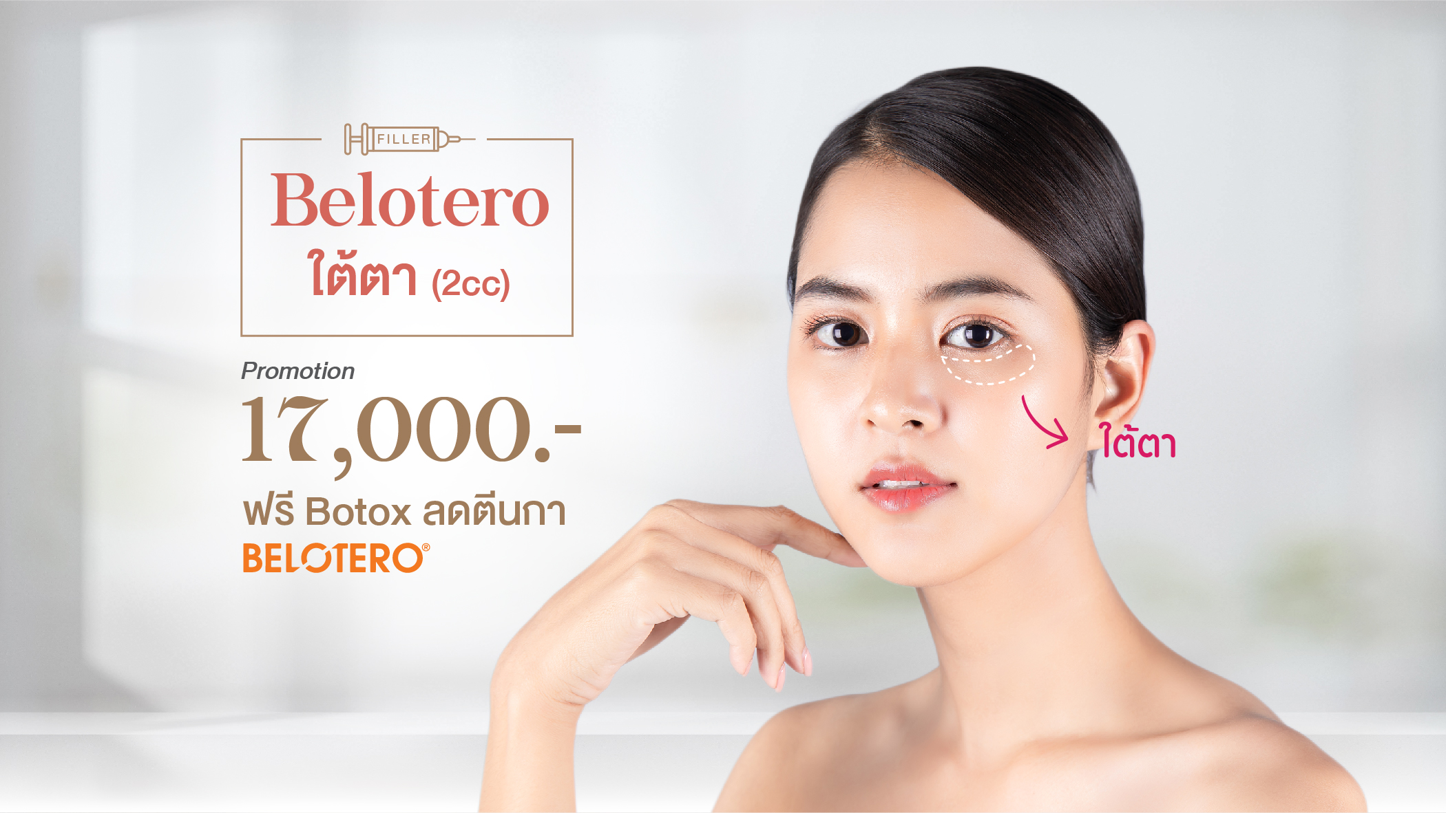 Belotero ใต้ตา ฟรี!! Botox