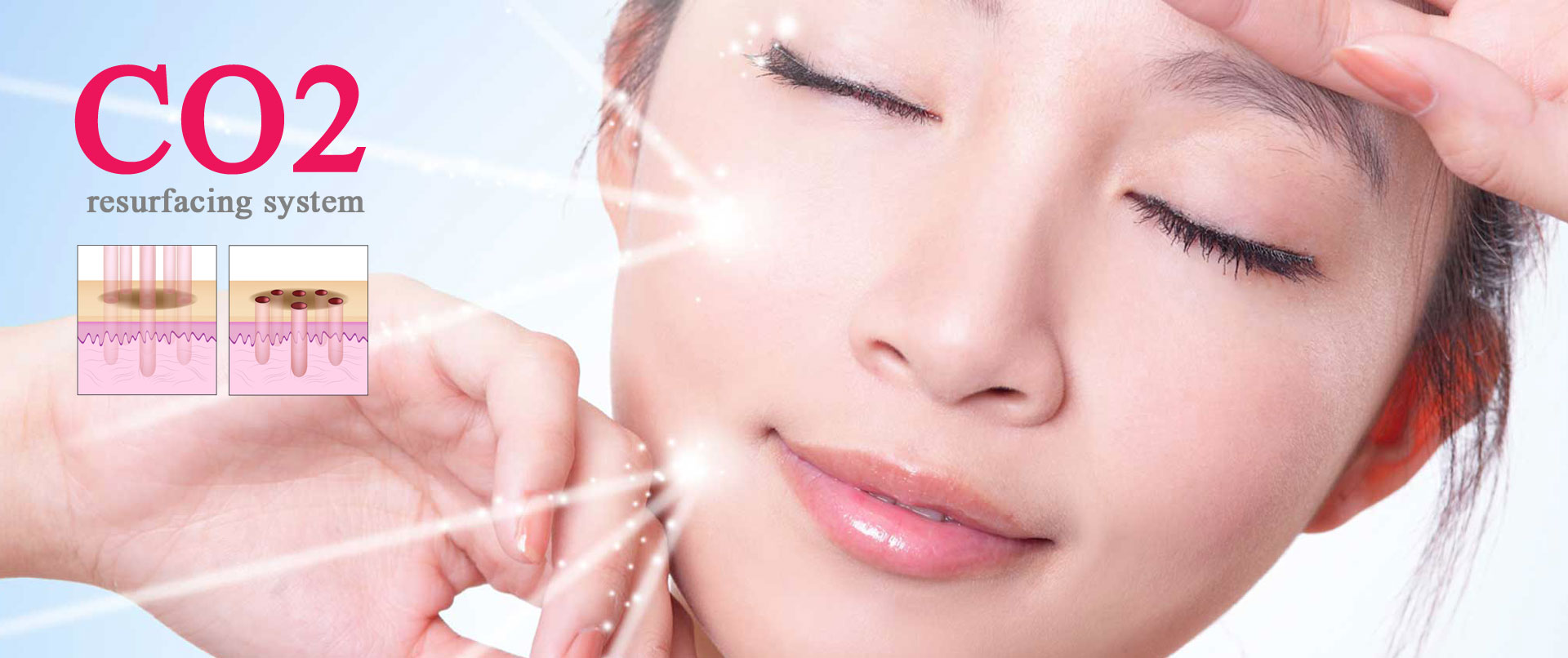 CO2 laser คืออะไร? ช่วยแก้ปัญหาผิวอะไรได้บ้าง ?