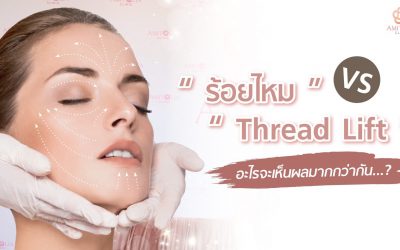 Hifu vs Thread Lift อะไรเห็นผลมากกว่ากัน?