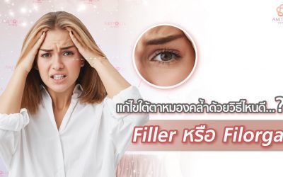 รักษาใต้ตาคล้ำ ควรใช้ Filler หรือ Filorga Nctf ดีกว่า??