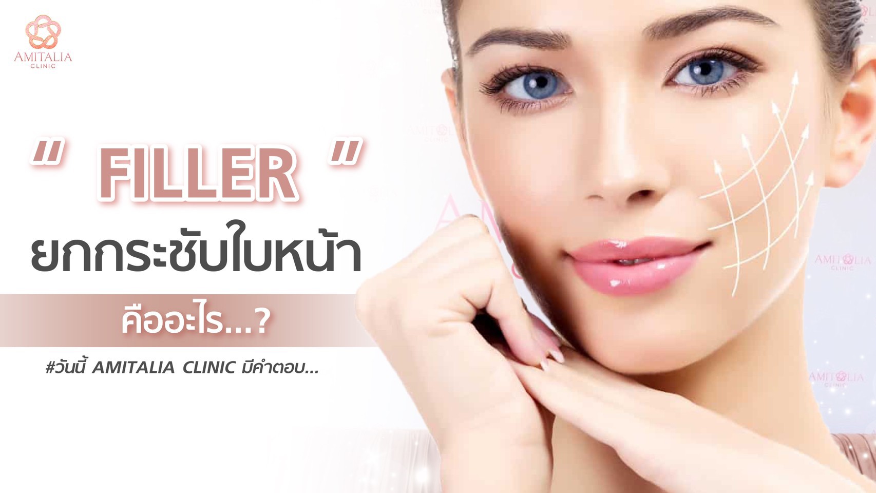 ฉีดฟิลเลอร์ยกกระชับใบหน้า คืออะไร