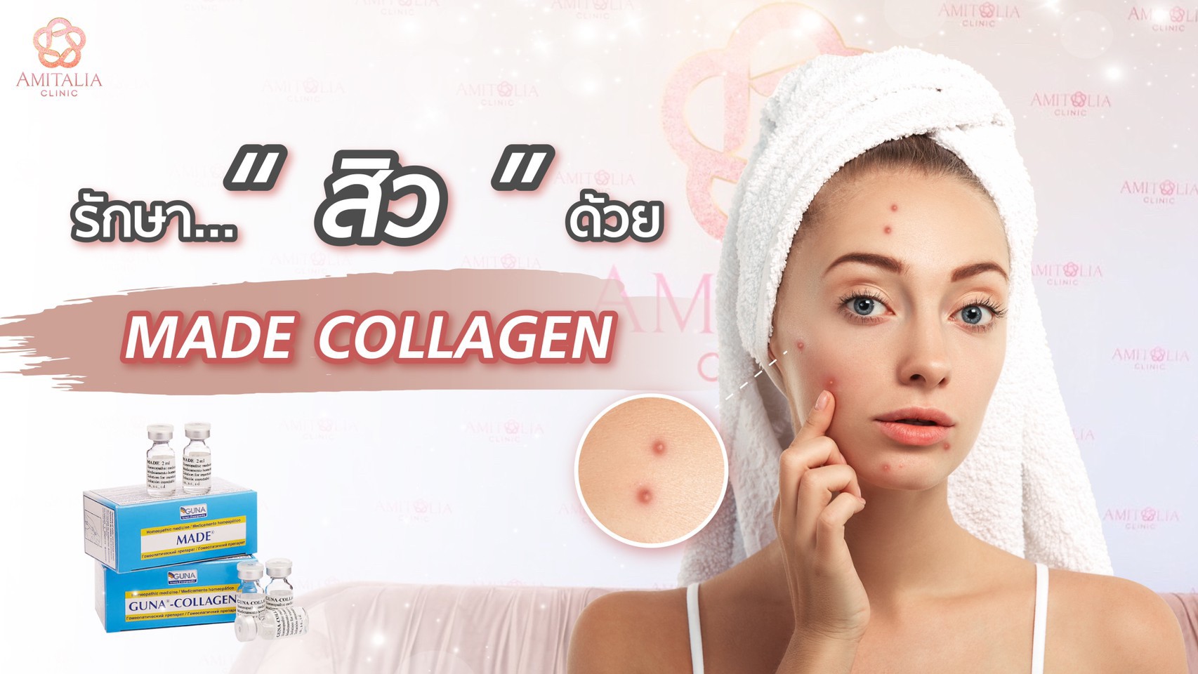 รักษาสิวด้วย Made Collagen ที่ Amitalia clinic