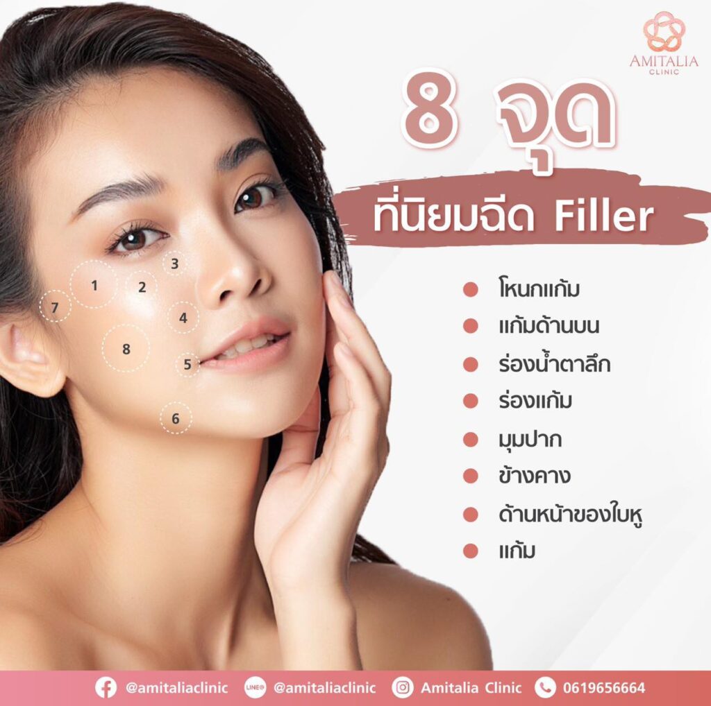 Review Filler คาง