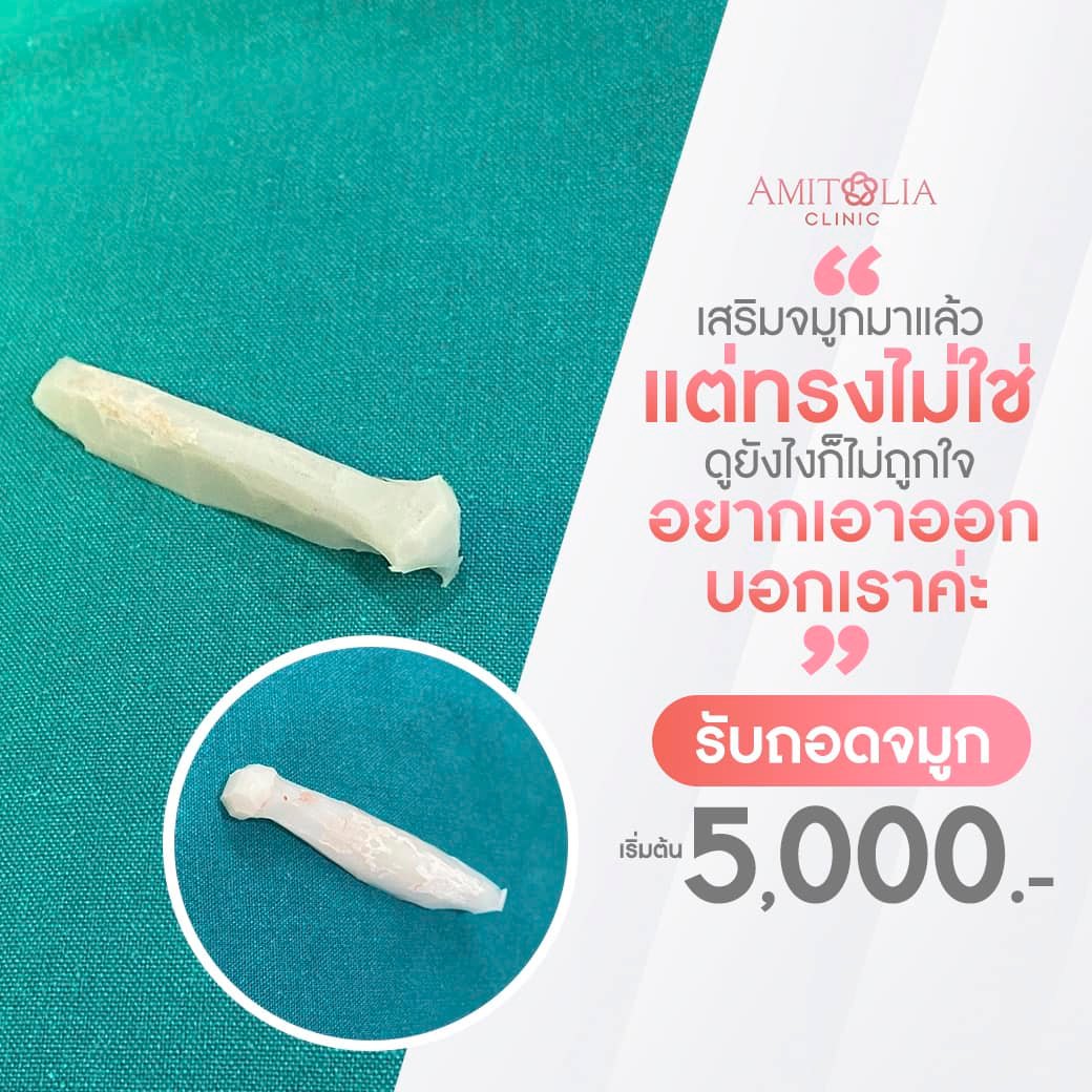 ทรงไม่ใช่ ทรงไม่โดน จะทนไปทำไม!! รับถอดจมูก