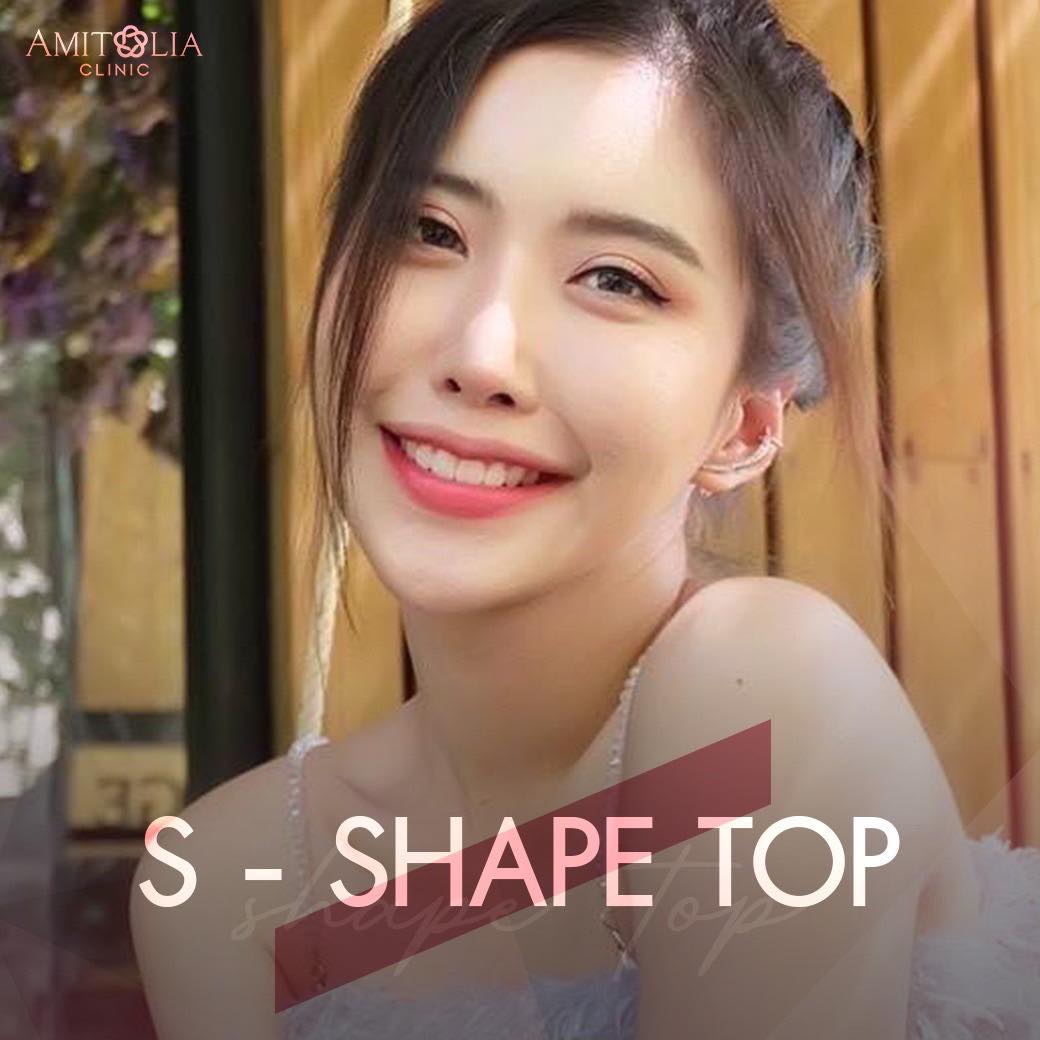 Review เสริมคาง #18