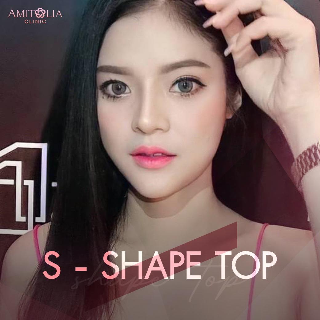 Review เสริมคาง-AmitaliaClinic