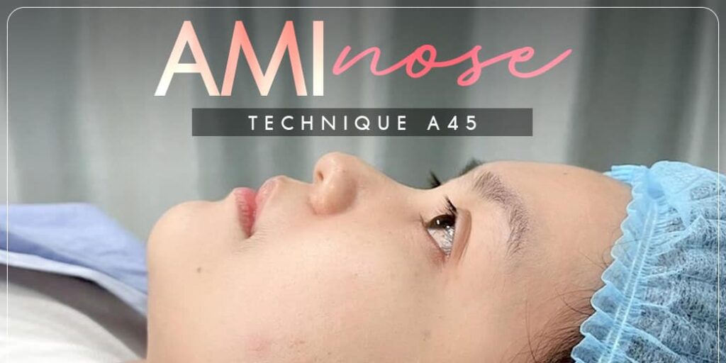 Review-เสริมจมูก-31-AmitaliaClinic