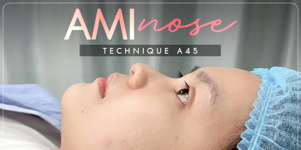 Review เสริมจมูก #31