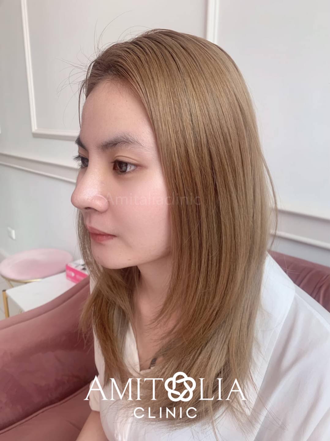 Review แก้จมูก + ตอกฐาน #54
