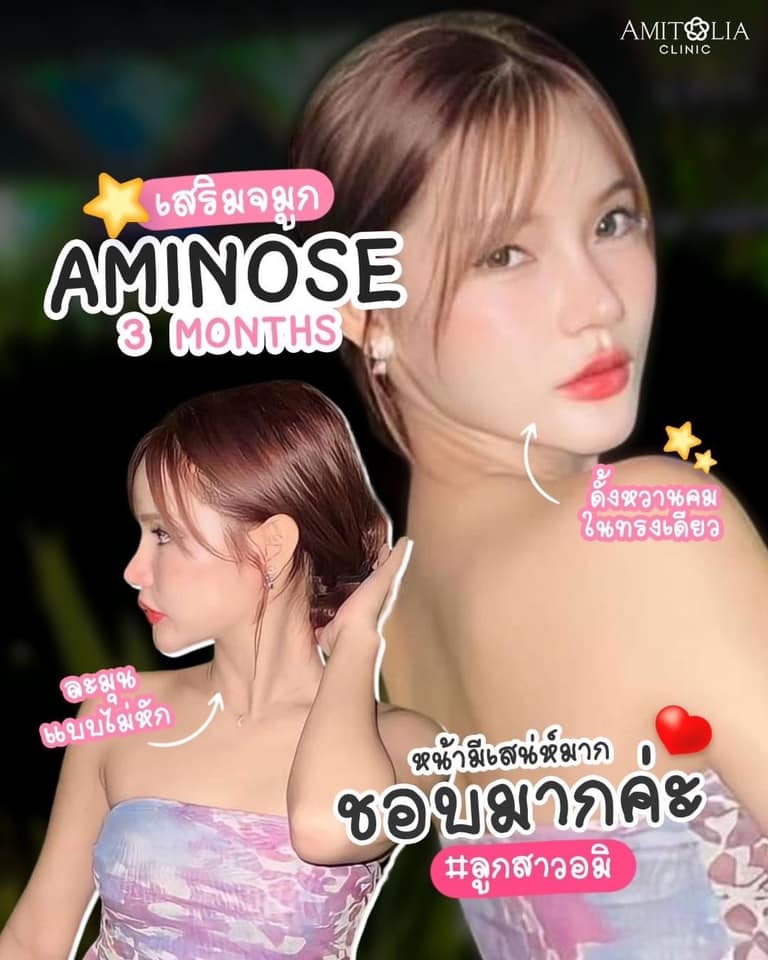 Review เสริมจมูก #70