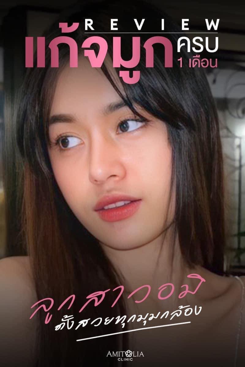 Review แก้จมูก #66