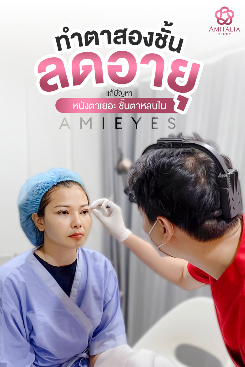 Review ตาสองชั้น #69