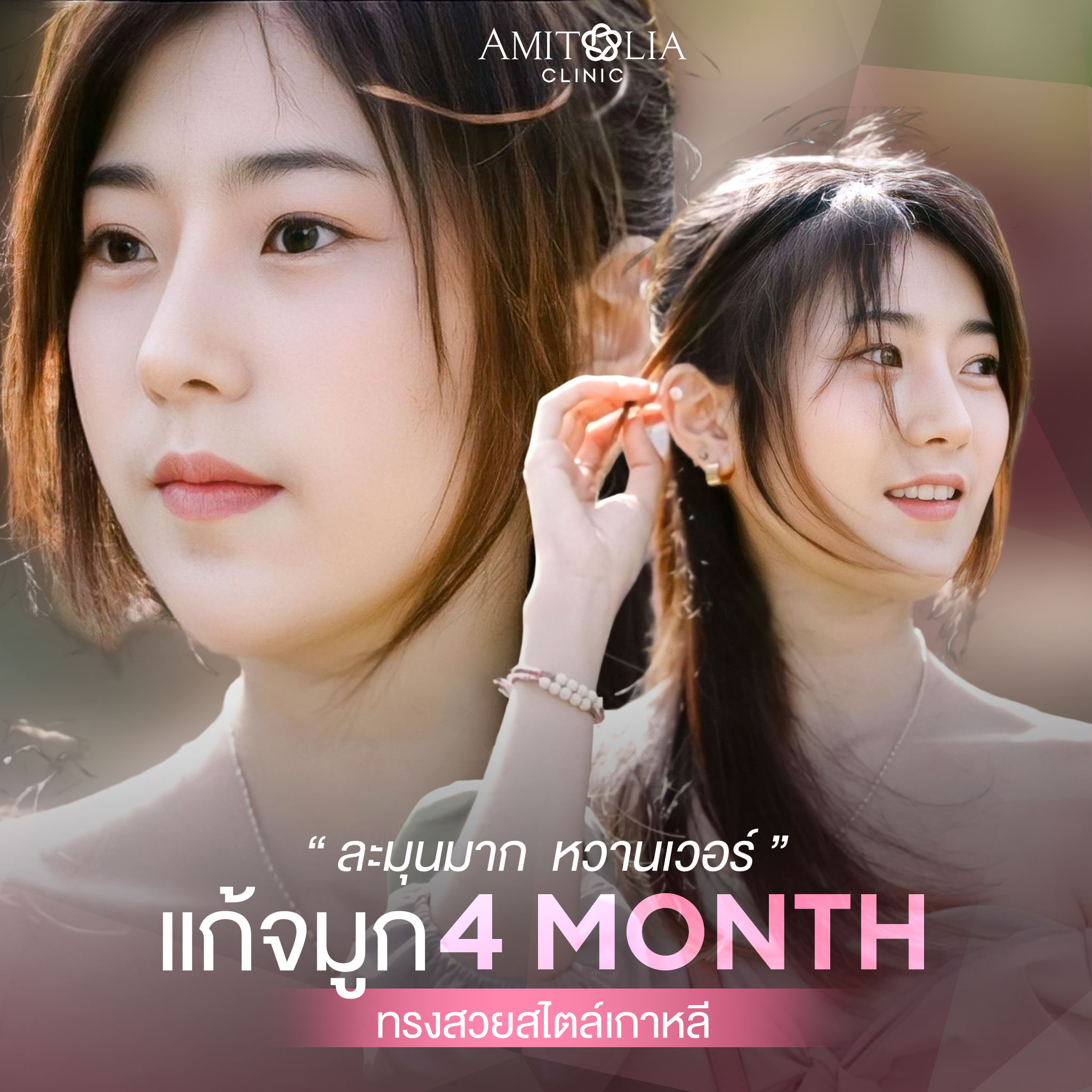 Review แก้จมูก #122
