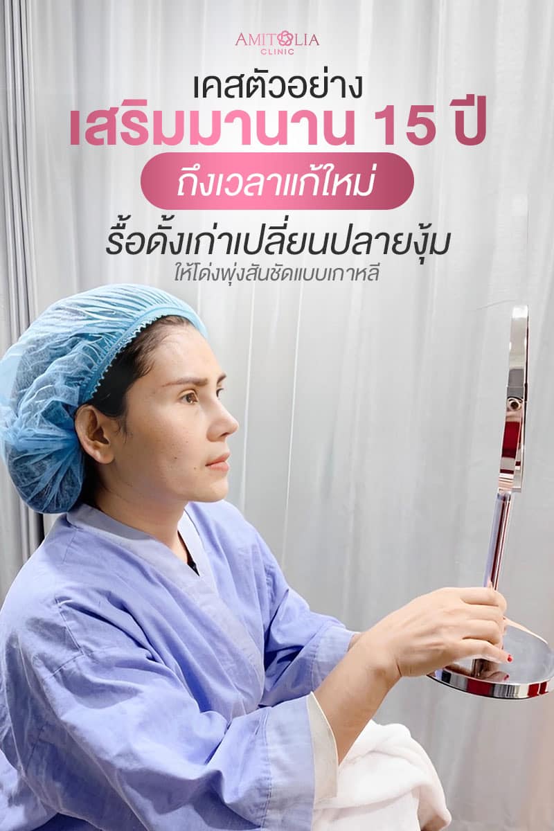 Review แก้จมูก #154