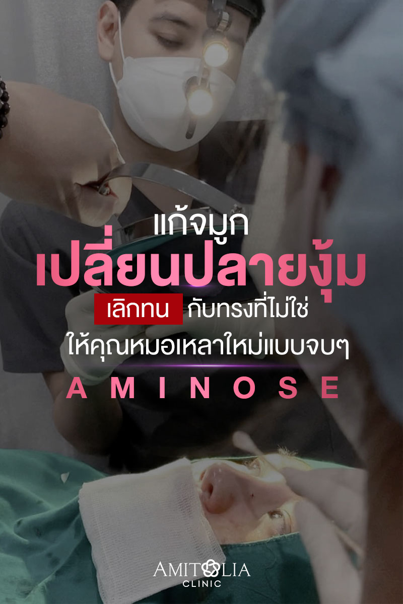 Review แก้จมูก #163
