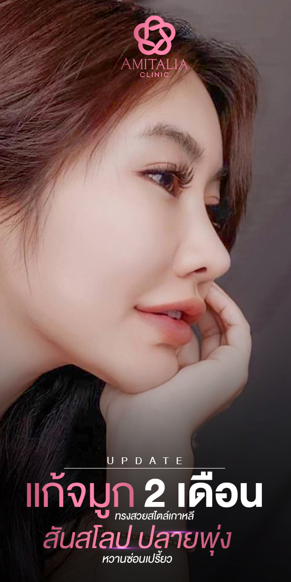 Review แก้จมูก #79