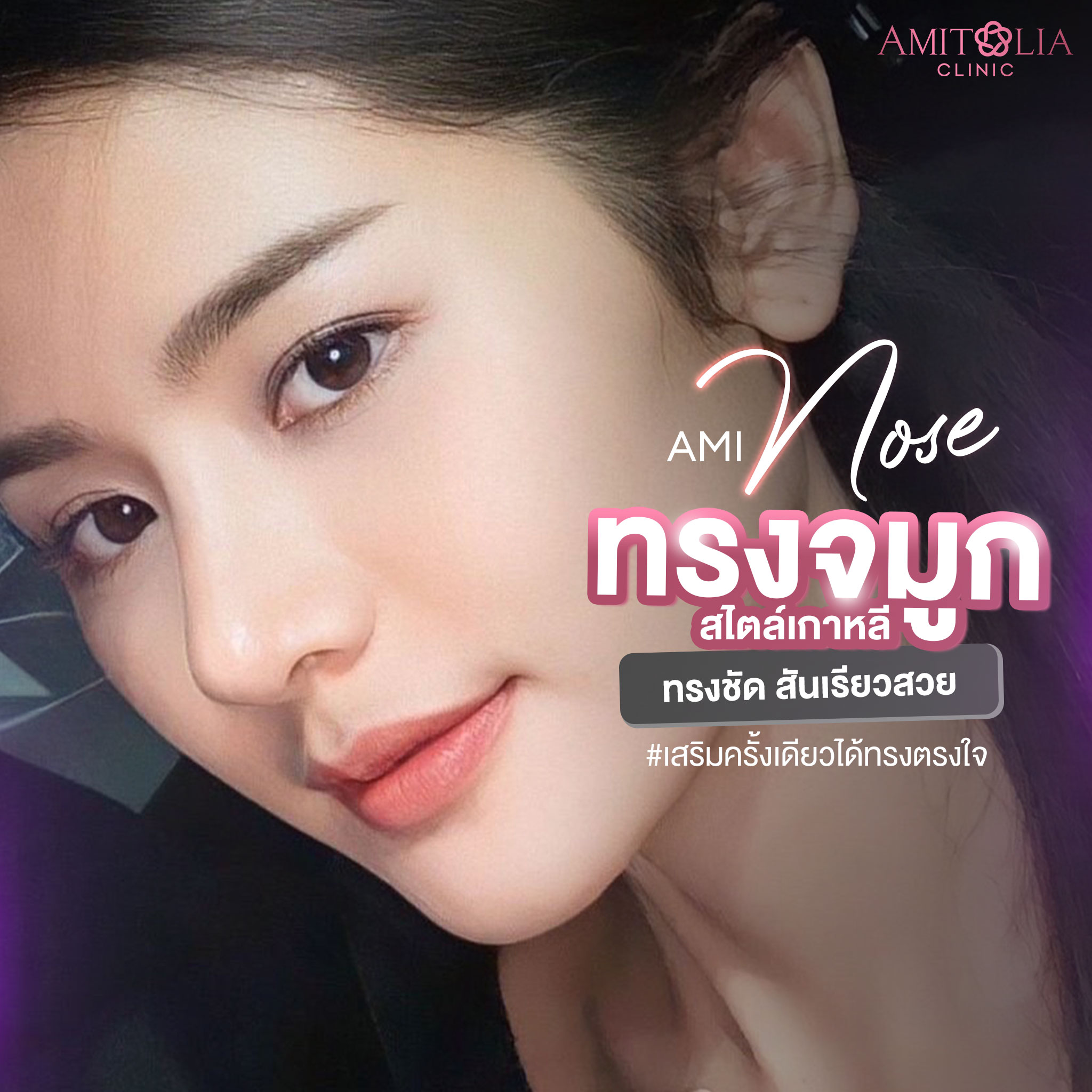Review เสริมจมูก #172