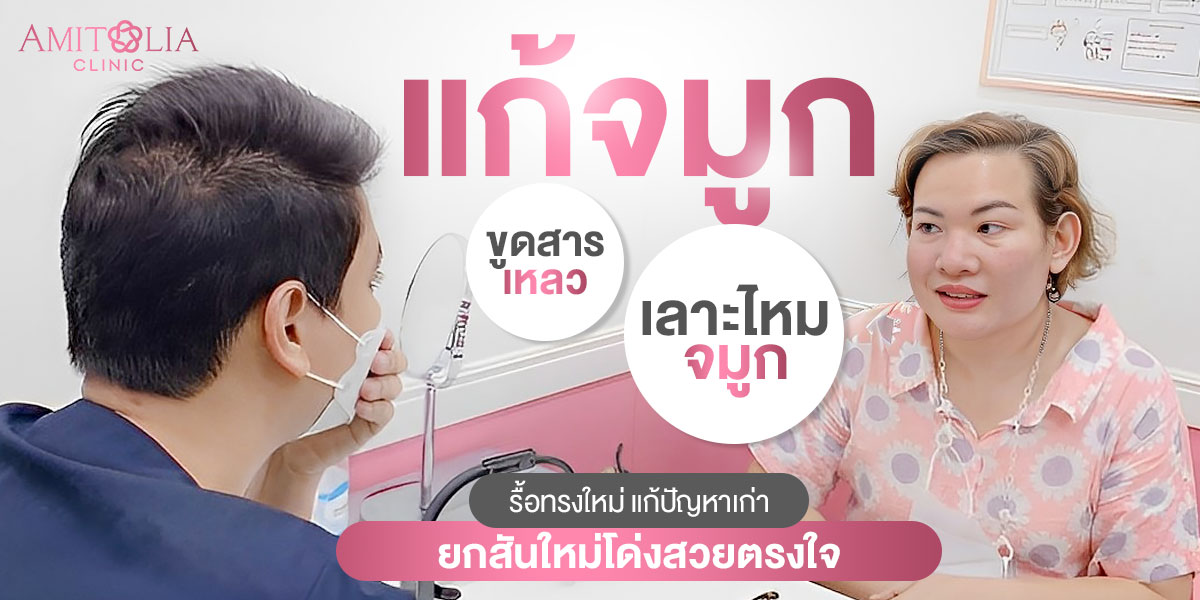 Review แก้จมูก #173