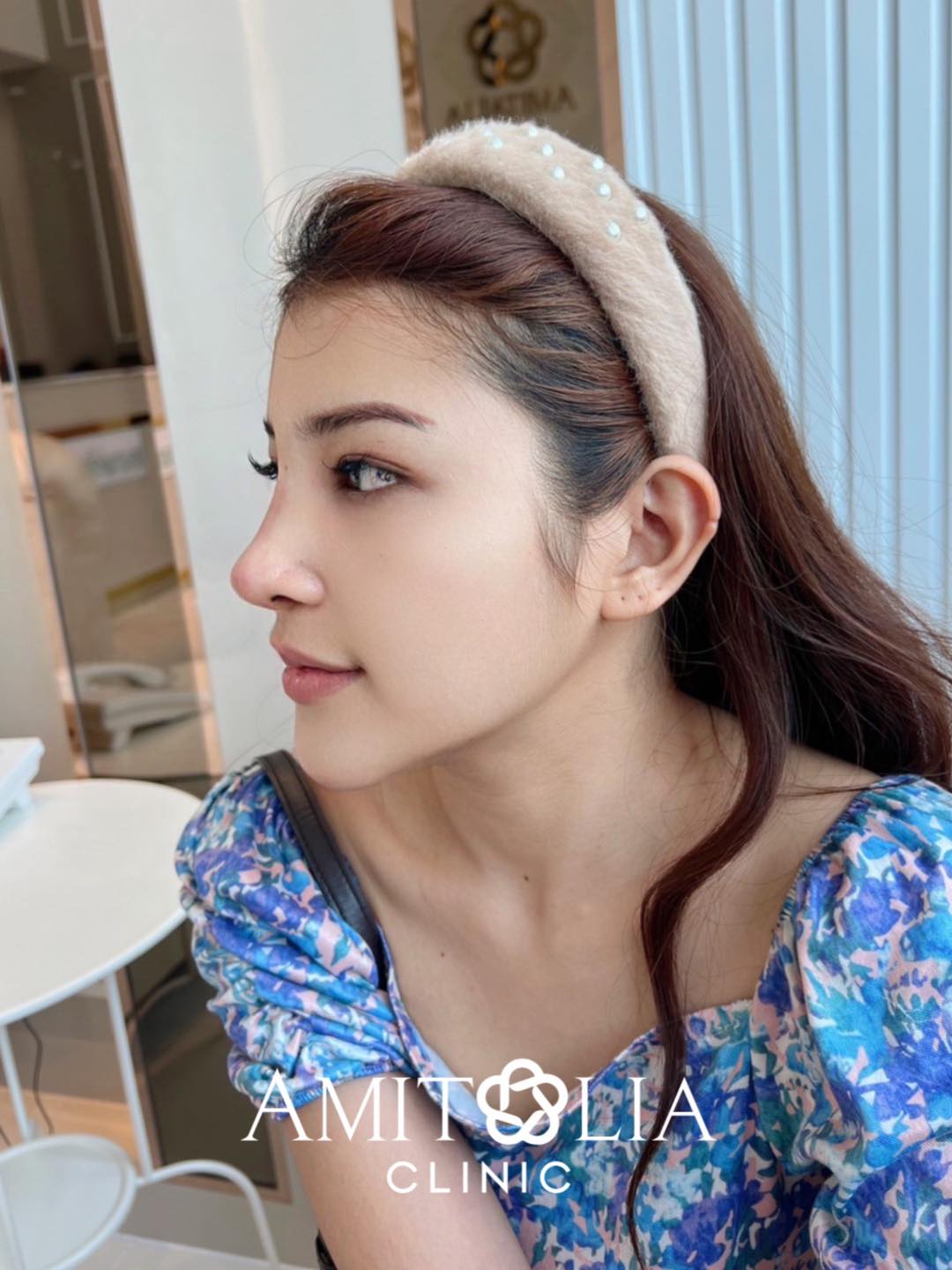 Review แก้จมูก #176