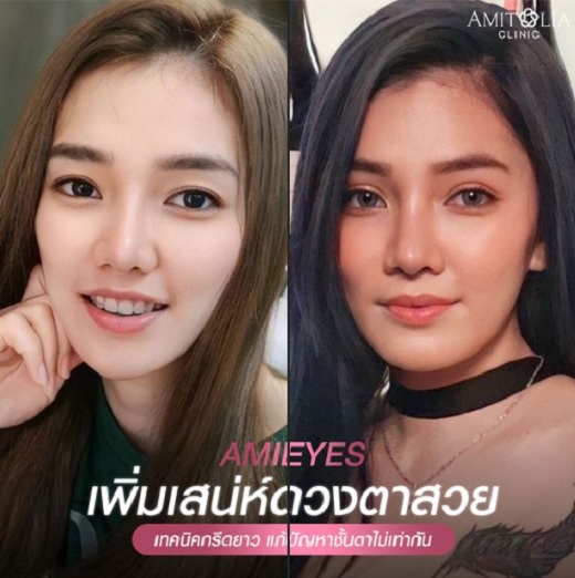 Review ตาสองชั้น #80