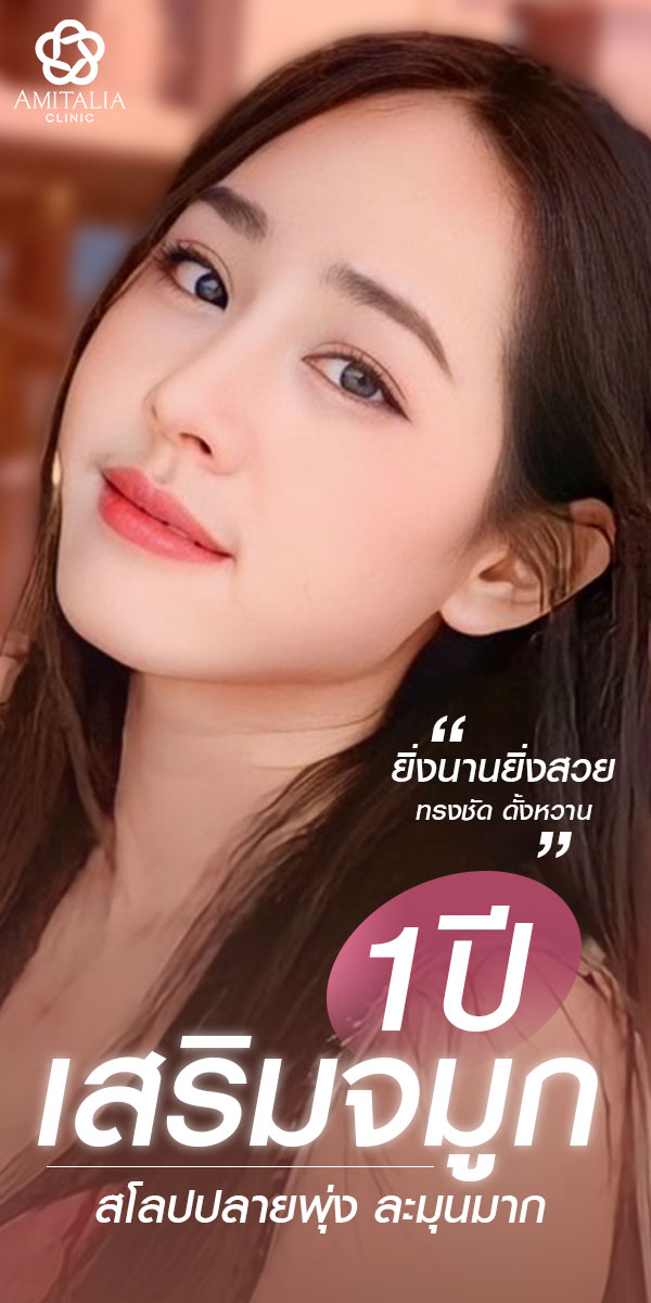 Review เสริมจมูก #218