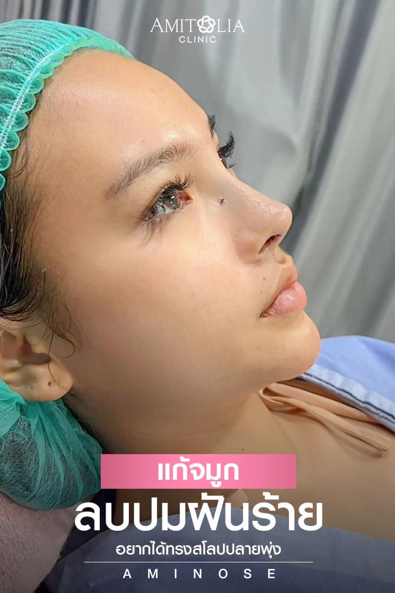 Review แก้จมูก #261