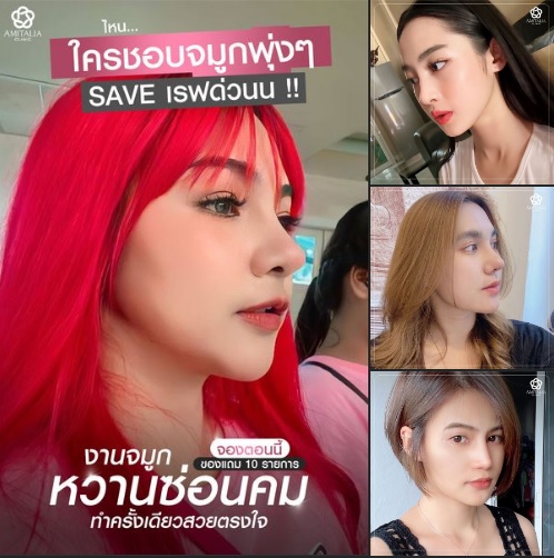 Review เสริมจมูก #281