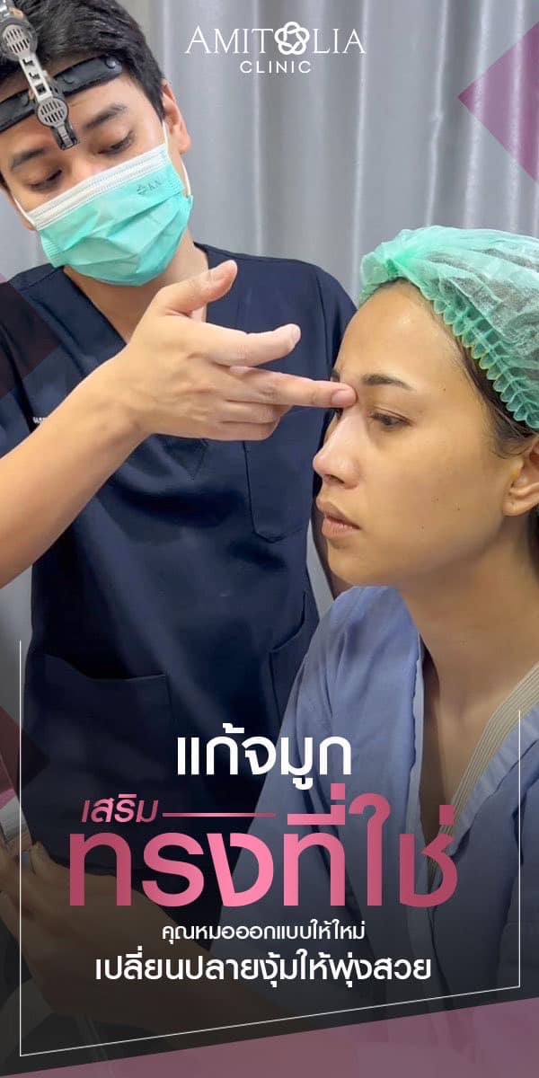 Review แก้จมูก #285