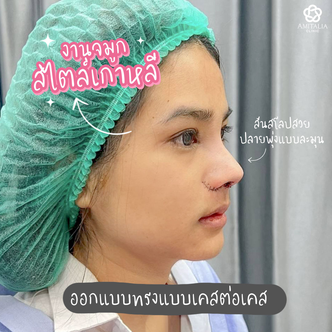 แก้จมูก #312