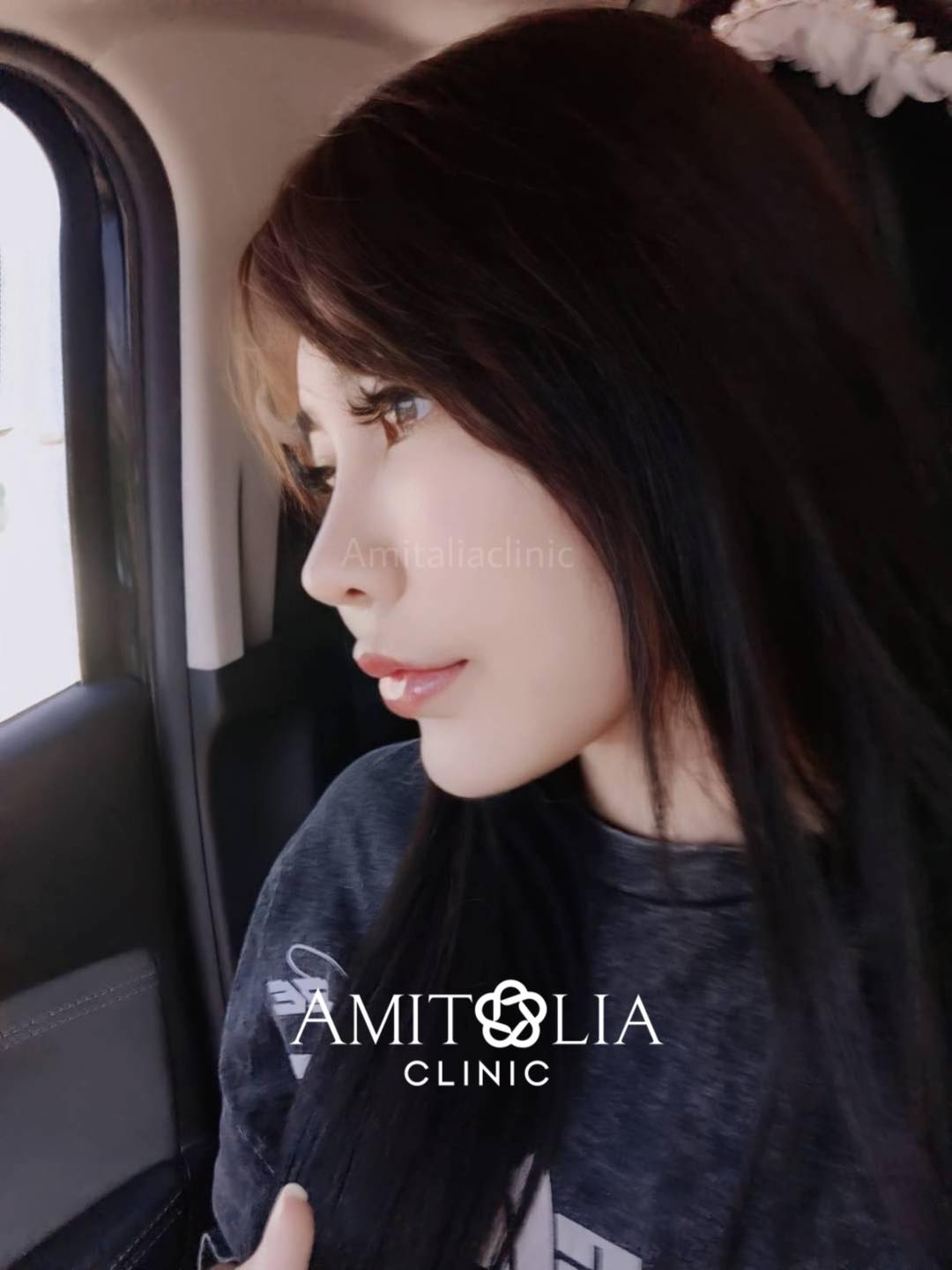 รีวิวละมุนใจทรงจมูกที่สวยหวานหน้าเด็ก