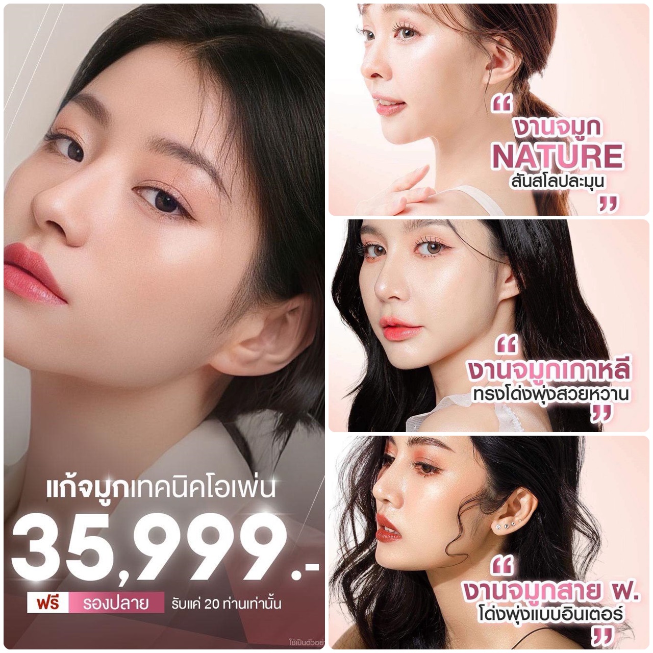 แก้จมูกด้วยเทคนิค OPEN