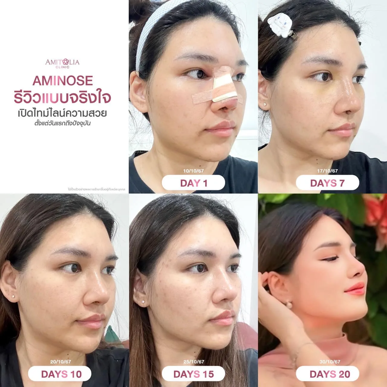 Aminose รีวิวจริงแบบไม่มีจกตา!