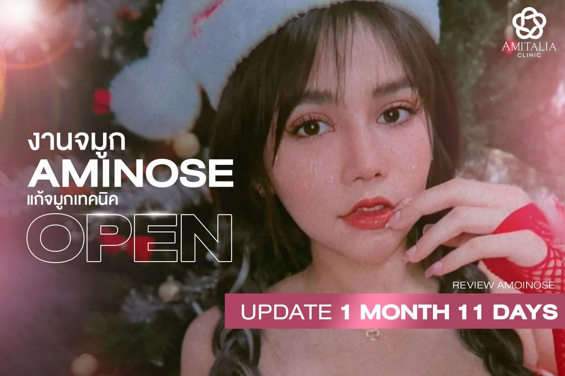 งานแก้จมูก Aminose อัปเดต 1 เดือน 11 วัน