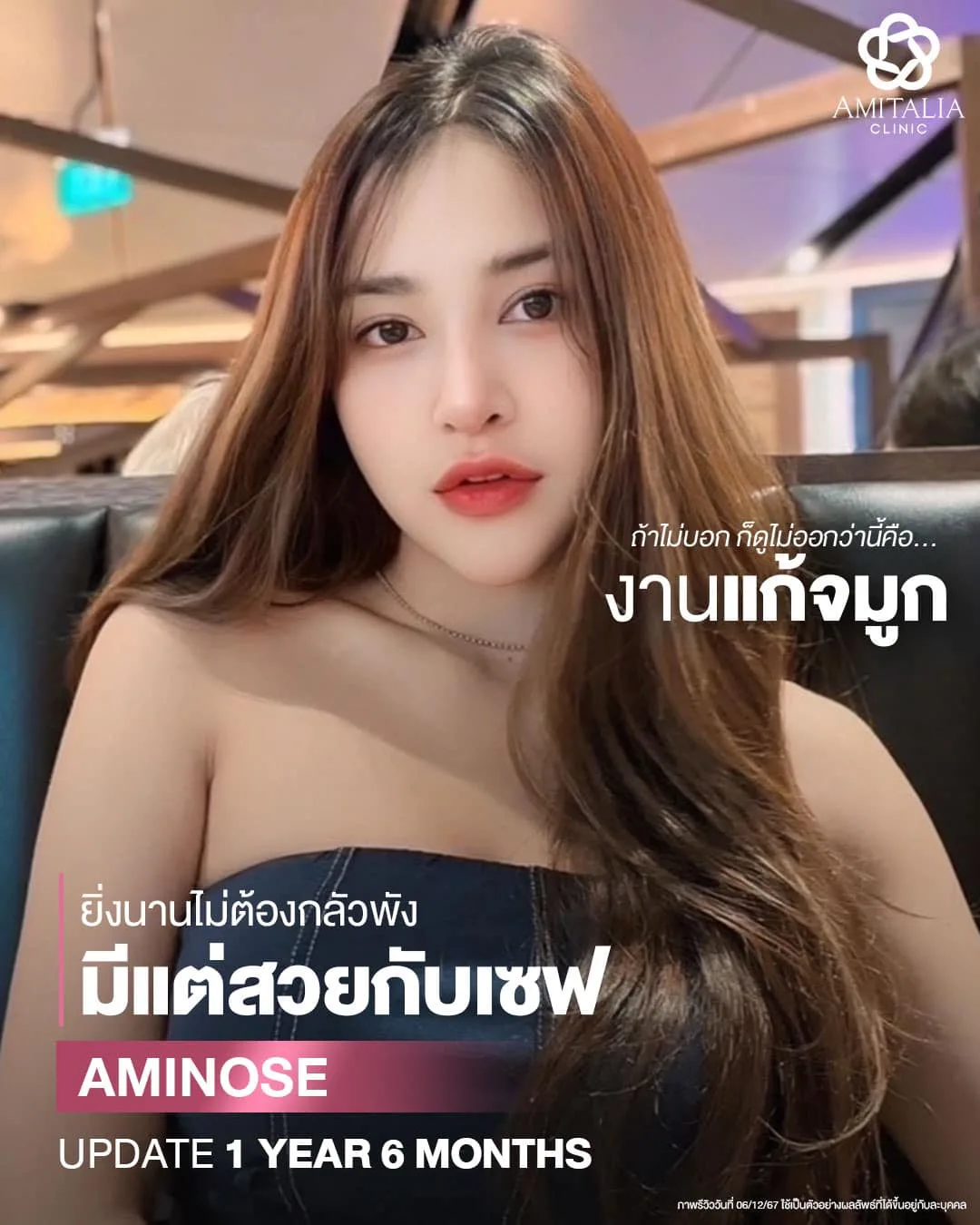 ใครบอกว่าแก้จมูกต้องเสี่ยง?