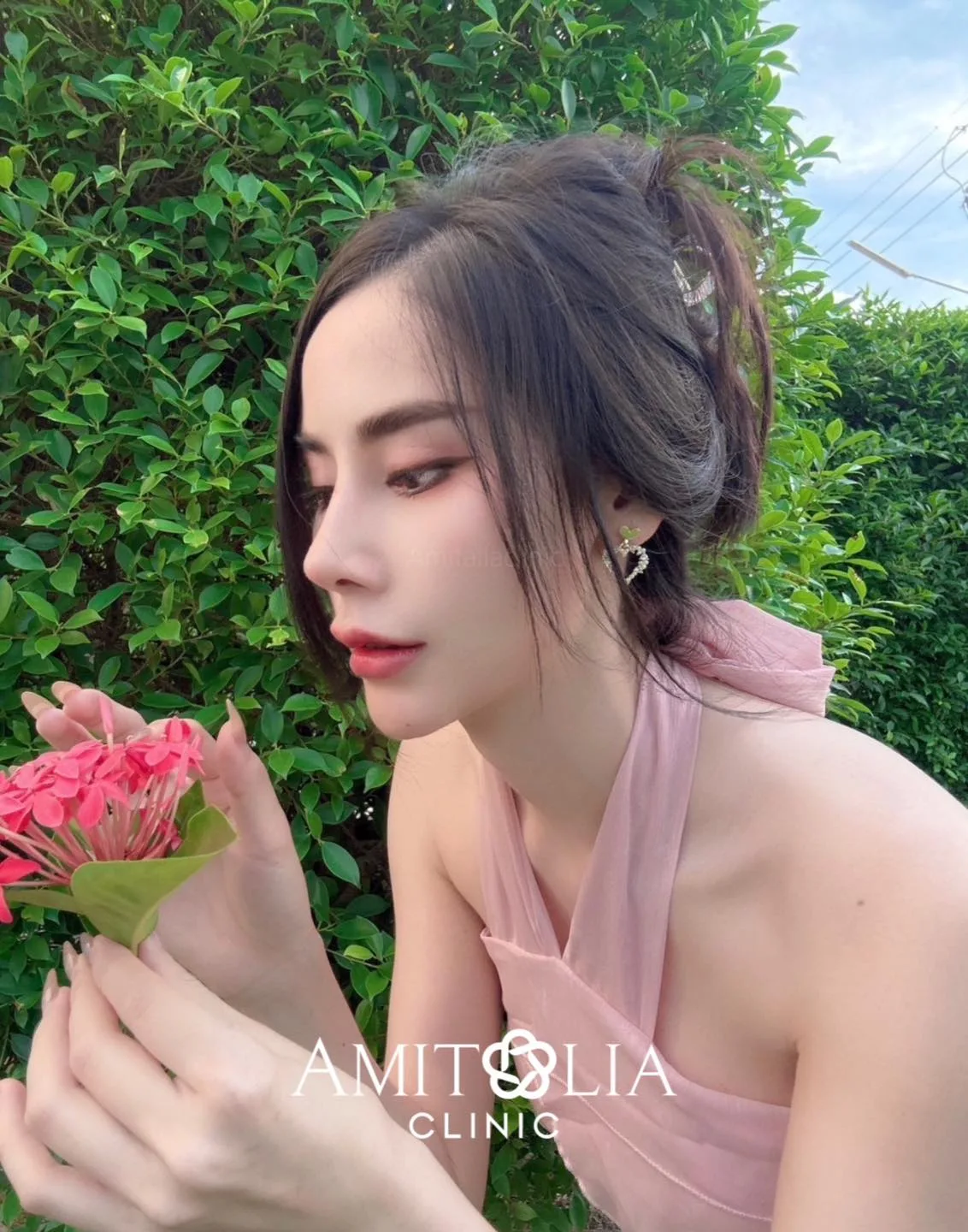 แก้จมูกครบ10เดือน โด่งพุ่งสวยหวานในมุมเดียวกัน