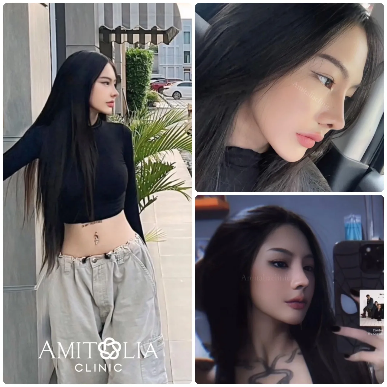 จมูกทรงนี้ยังไม่ครบเดือนเลยค่ะ
