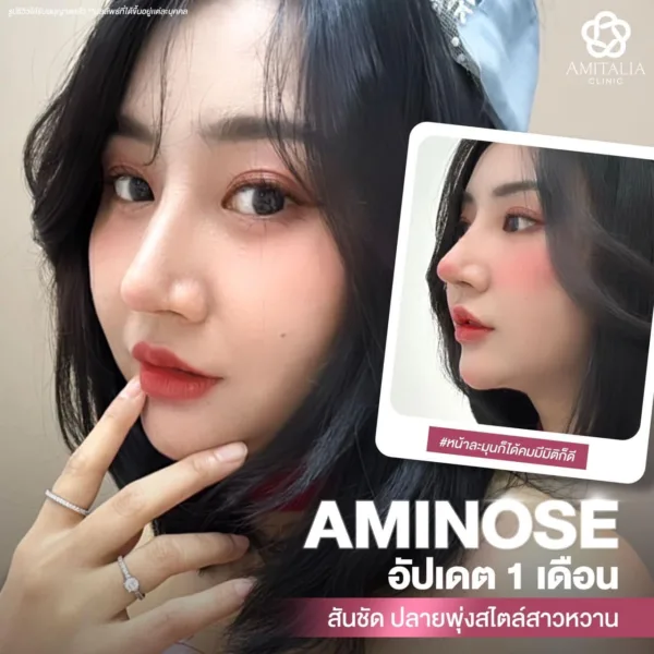 หลังแก้จมูก