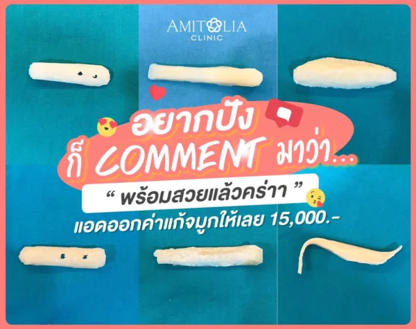 จมูกทรงไม่สวย