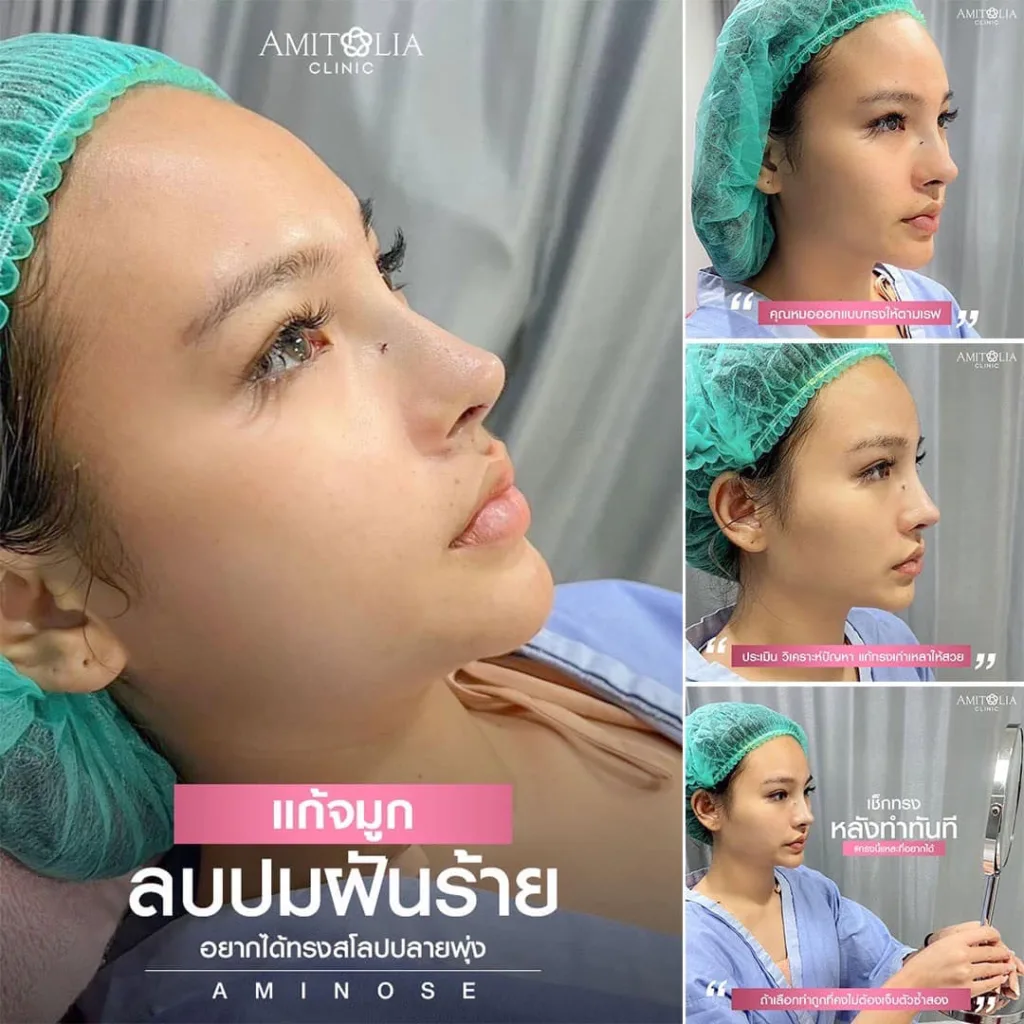 แก้จมูก