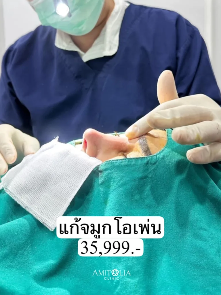 แก้จมูก