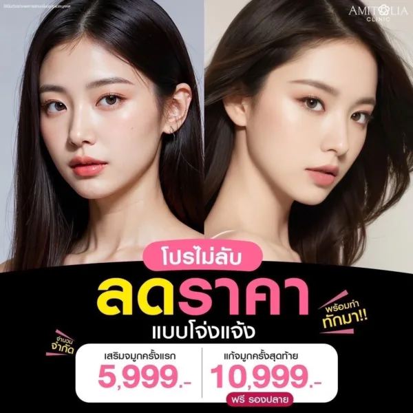 โปรโมชั่น