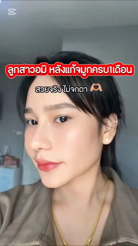 แก้จมูก