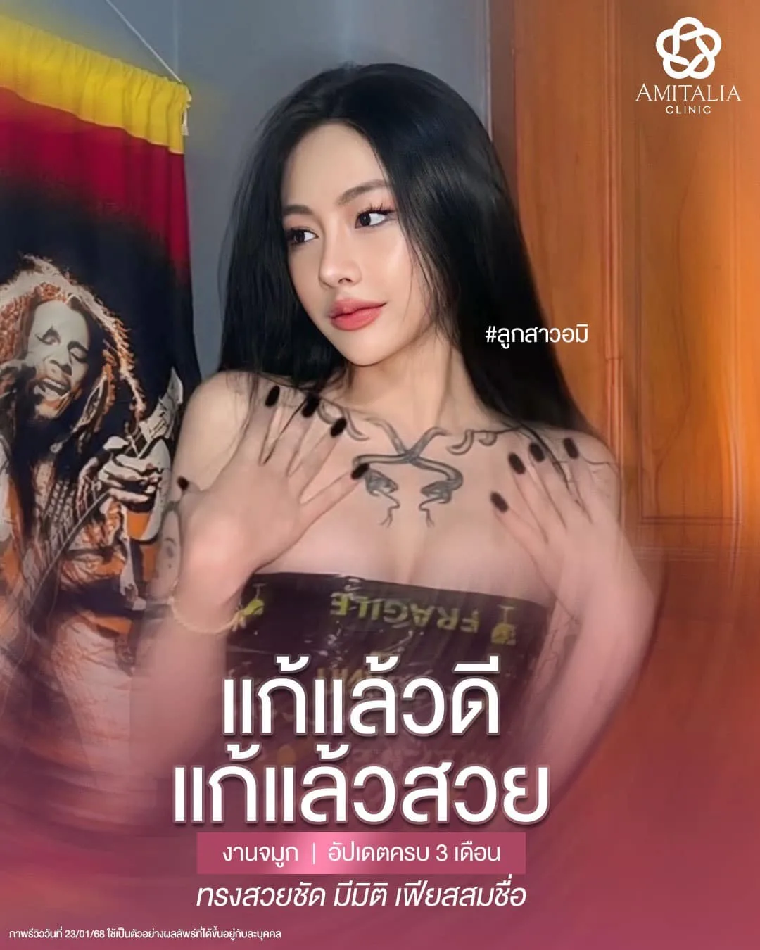 งานแก้จมูกที่จบแบบสับ…
