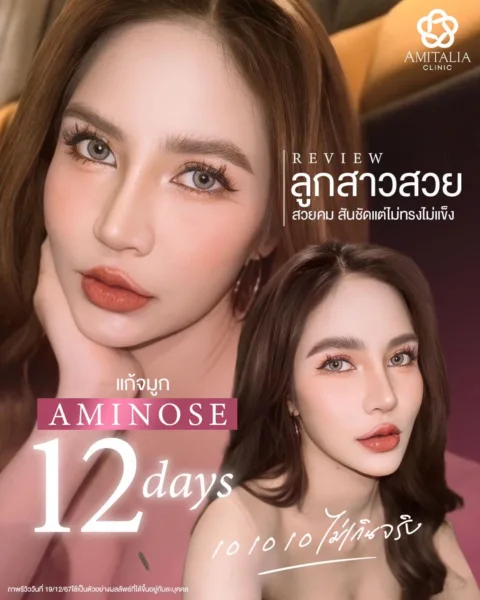 หลังแก้จมูก