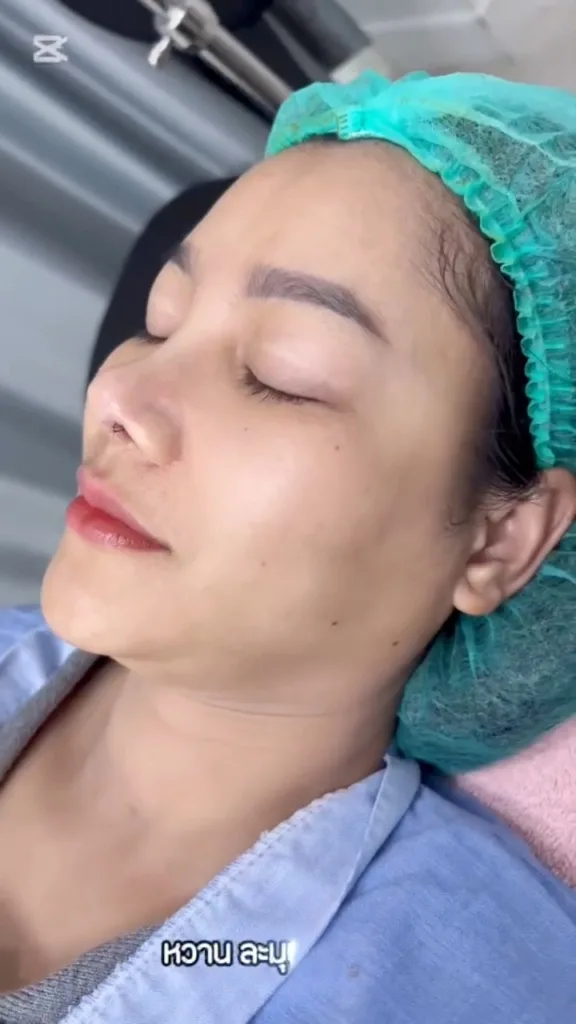 หลังแก้จมูก