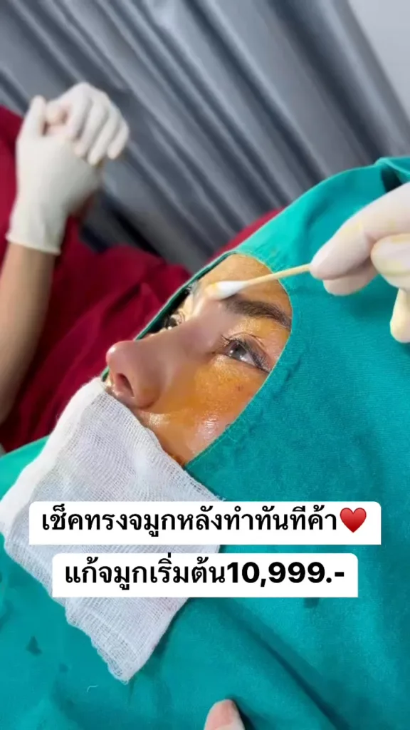 เช็คทรงจมูก