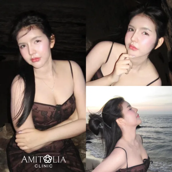 รีวิวจมูก