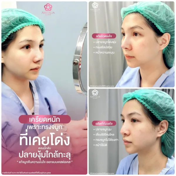 จมูกใหม่