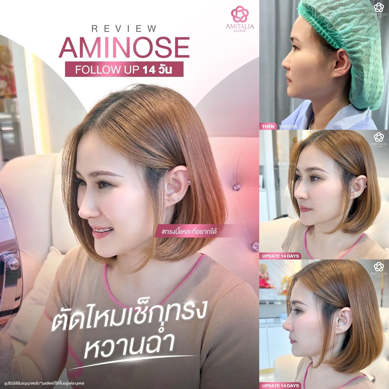 ตัดไหมแล้ว เช็กทรงแล้วคือหวานฉ่ำเกินต้าน